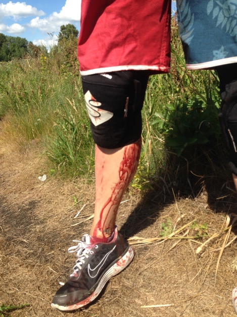 Due to the red color of the shorts it is difficult to tell that the right leg was soaked in blod